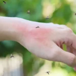 Why Mosquito Infestation Increases During Certain Seasons