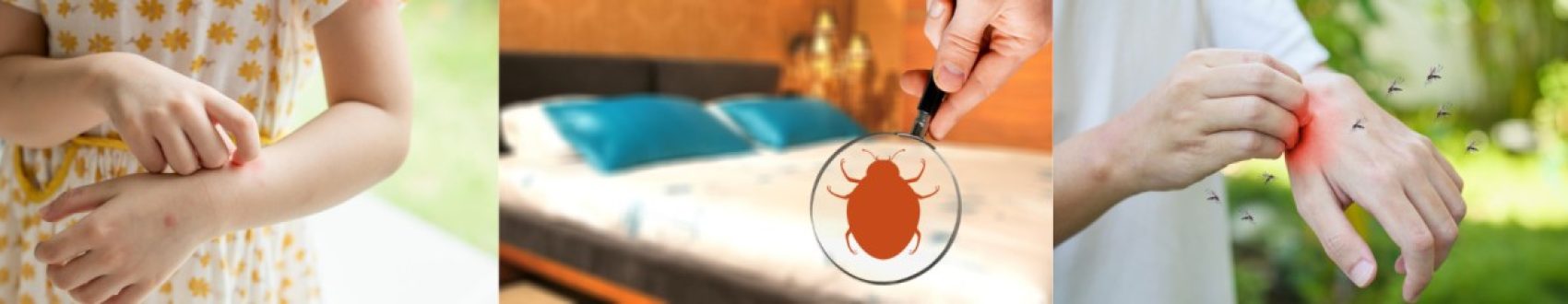 The Dangers of Bed Bugs Health Risks and Allergies in Sharjah